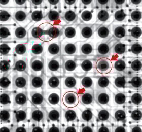 BGAの実装不良X線画像｜松定プレシジョン