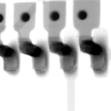 電子部品の実装部分拡大X線画像｜X線非破壊検査装置導入事例｜松定プレシジョン