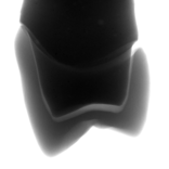 歯科材料（義歯など）のX線画像｜X線非破壊検査装置導入事例｜松定プレシジョン