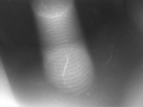 ダイカストのX線クラック画像｜X線非破壊検査装置導入事例｜松定プレシジョン