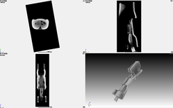 圧着端子のX線CT画像｜X線非破壊検査装置導入事例｜松定プレシジョン