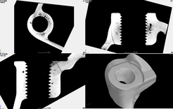 アルミダイカストのX線CTボイド画像｜X線非破壊検査装置導入事例｜松定プレシジョン