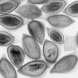 種子のX線画像3｜X線非破壊検査装置導入事例｜松定プレシジョン