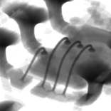 ICのワイヤボンディング立体X線画像1｜X線非破壊検査装置導入事例｜松定プレシジョン