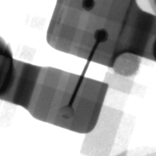 ICのワイヤボンディングX線画像｜X線非破壊検査装置導入事例｜松定プレシジョン