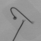 ICのワイヤボンディング立体X線画像2｜X線非破壊検査装置導入事例｜松定プレシジョン