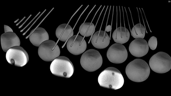 BGA（拡大検査）に最適なX線検査装置の画像3｜松定プレシジョン