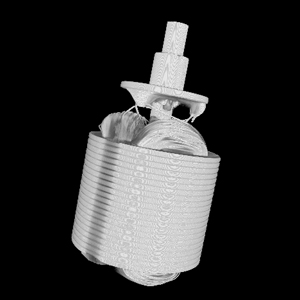 モーターのX線検査画像｜松定プレシジョン