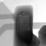 はんだ付けのクラックX線画像｜X線非破壊検査装置導入事例｜松定プレシジョン