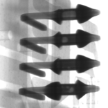 スルーホールのはんだ付けX線画像｜X線非破壊検査装置導入事例｜松定プレシジョン