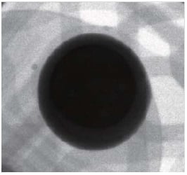 BGA（拡大検査）｜X線検査装置の正しい選び方｜松定プレシジョン