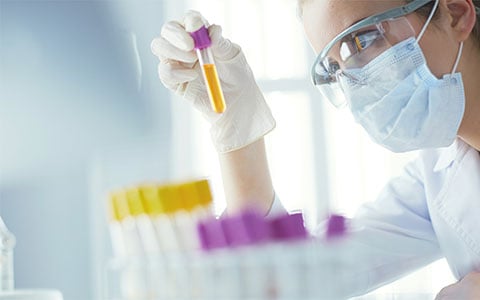 フローサイトメトリーとは？ フローサイトメトリーの基礎やフローサイトメーターについても解説｜松定プレシジョン