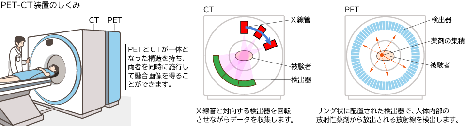 PETスキャナー
