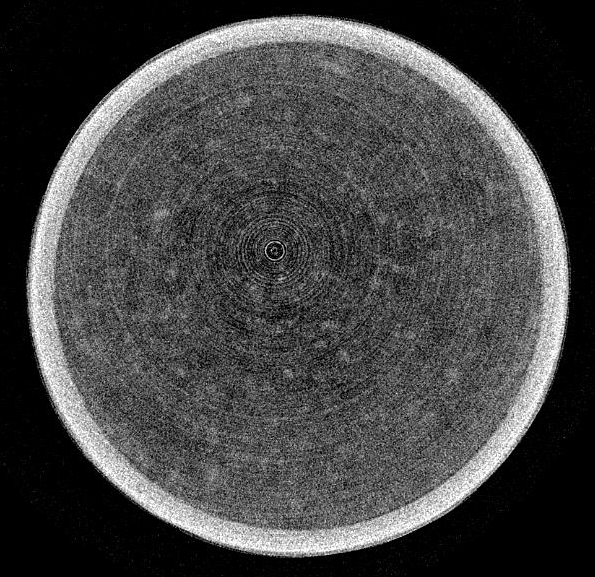 リングアーチファクト