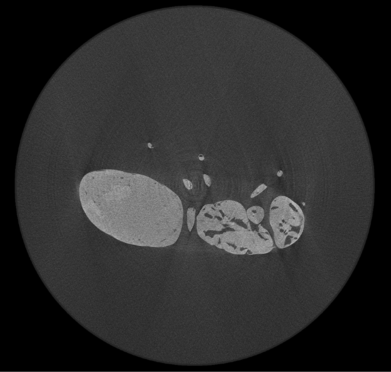 シャワー状アーチファクト