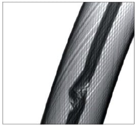 線材の断線｜X線検査装置の正しい選び方｜松定プレシジョン