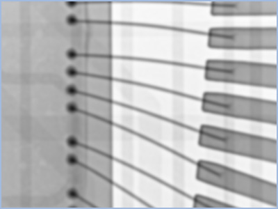 焦点が大きいタイプ｜マイクロフォーカスX線とは（基礎知識）